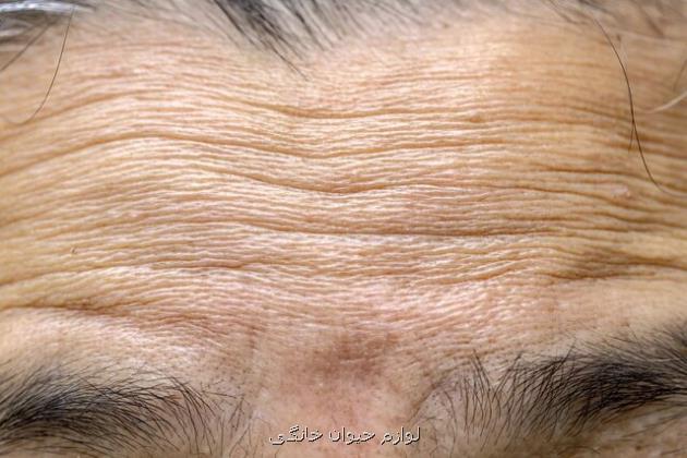 کشف سازوکار چروک شدن پوست با افزایش سن