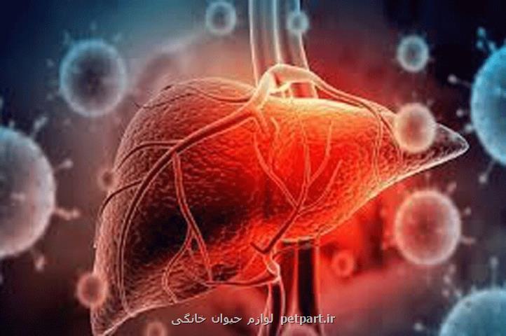 این 3 راه درمان کبد چرب را فراموش کنید