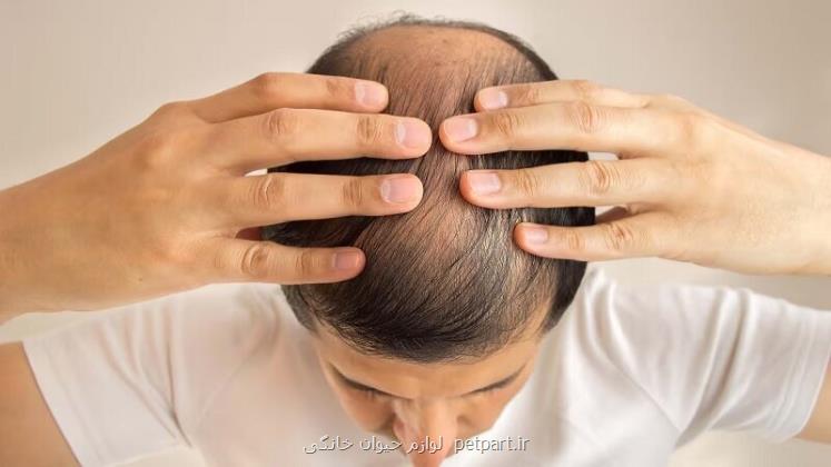 این داروی درمان ریزش مو سبب ایجاد افکار خودکشی می شود